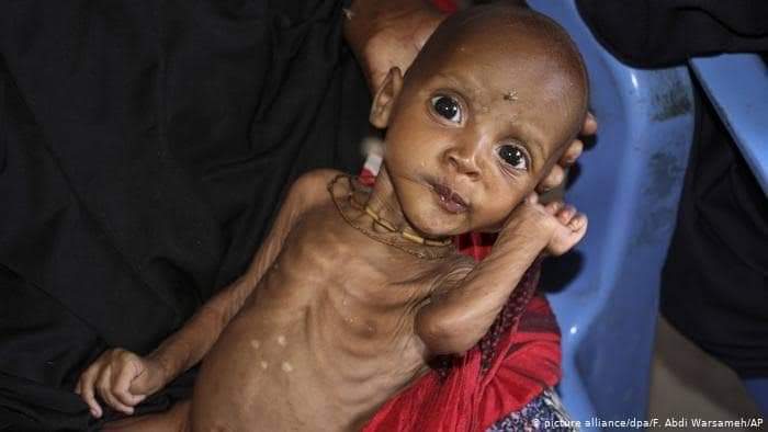خطر المجاعة في اليمن 